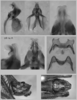 Melanoplus stupefactus (Scudder, 1876): male genitalia. (Otu).