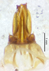 CollectionObject 1477843; a1aa5fe7-8182-4931-9db1-504a76fca5cc: male genitalia, dorsal view (holotype). (CollectionObject).