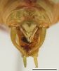 CollectionObject 1588353; 8254f42f-1db1-4e4c-9d7c-787b78eb16b3: male abdomen tip, scale bar 2mm. (CollectionObject).