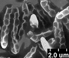 Brochosomes on Dichrophleps Stål, 1869: DP47 | Costa Rica, Puntarenas, Golfito, 7/27-28/1975 | E.M. Fisher | CAS. (Observation).