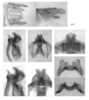 Melanoplus ablutus Scudder, 1899: male genitalia. (Otu).