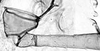 Stylus.: First marginal tubercle and coxa of A. spiraecola. (Observation).