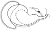 Euschmidtia viridifasciata Descamps, 1973: Fig. 21. endophallus, lateral view. (Otu).