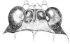 Fig. 131. male, head, dorsal view. Depicts Paratettix rugosus (Scudder, 1862), an Otu.