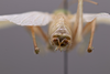 CollectionObject 2072283; c8d52735-8ce8-4024-8146-9b5b81ad3050: Male terminalia, axial view. (CollectionObject).