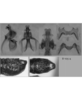 Melanoplus stupefactus (Scudder, 1876): male genitalia. (Otu).