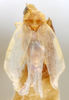 Habitus, dorsal view: !! display not done !! on Erasmoneura vulnerata (Fitch, 1851): Habitus (holotype, NYSM collection). (Observation).