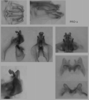 Melanoplus propinquus Scudder, 1897: male genitalia. (Otu).