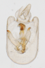 Pygofer, ventral view: !! display not done !! on Saccharosydne saccharivora (Westwood, 1833): (Observation).