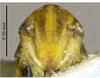 Head on Arboridia (Arboridia) reniformis Song & Li, 2013: (Observation).