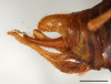 CollectionObject 1588352; e89cb9ff-a585-4f2e-bd23-88b195bb66b5: male abdomen tip, scale bar 2 mm. (CollectionObject).