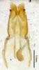CollectionObject 1477623; ffbb23c7-dee5-4ea0-ba2b-6d9fe06574be, ANSP1116: male genitalia, dorsal view (holotype). (CollectionObject).