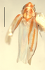 Habitus, dorsal view on Erythridula scytha (Auten & Johnson, 1936): Habitus (holotype of E. bowmanorum Hepner, INHS collection). (Observation).