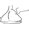 Pygofer, lateral view: Pygofer, lateral view. (Observation).
