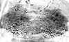 Connective.: Hairs on subgenital plate of A. decepta. (Observation).