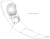 Neomenocria advena (Spinola, 1839): (Otu).