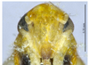 Head on Arboridia (Arboridia) tridentata Song & Li, 2013: (Observation).