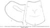 Metaprosagoga insignis (Vignon, 1924): Fig. 90 (after type). male pronotum, lateral and dorsal view (length 6.5 mm). (Otu).
