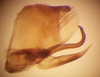 Pygofer, lateral view on Costanana dunda DeLong & Freytag, 1972: Male holotype [OSU]: pygofer, valve, style and subgenital plate, lateral view. (Observation).