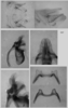 Melanoplus childsi Otte, 2012: male genitalia. (Otu).