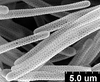 Brochosomes: AG38 | Brazil, SP, Bebedouro | 5/14/1998 | Roberto, S. | INHS. (Observation).