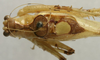 CollectionObject 1535904; bfbf330f-6025-47b1-a31c-a7273169fd67: male pronotum, dorsal view. (CollectionObject).