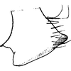Pygofer, lateral view on Bolanusoides bohater Dworakowska, 1988: Pygofer lobe, lateral view. (Observation).