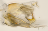 Pygofer, lateral view: (Observation).