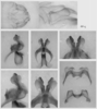 Melanoplus angustipennis (Dodge, 1877): male genitalia. (Otu).