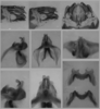 Melanoplus borealis (Fieber, 1853): male genitalia. (Otu).