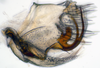 Pygofer, lateral view: (Observation).