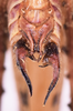 CollectionObject 1583379; 27ff00fb-a207-442f-a437-082c7dbd33e9: male, terminalia ventral view (paratype). (CollectionObject).