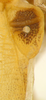 CollectionObject 1543806; 1dfade2e-bea3-4bb0-a6cb-8dcd913f5bfa: male left stridulatory area, whole view (holotype). (CollectionObject).