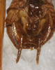 CollectionObject 1532348; f1722499-f6ba-46c1-b2df-ff6ee62fb080: male abdomen tip, ventral view (holotype). (CollectionObject).