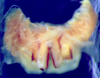 CollectionObject 1516490; a3448119-7806-4f99-b4c8-5348a5395b69: male titillators (paratype). (CollectionObject).