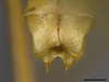 CollectionObject 2189003; 3e92da30-72d7-4127-a757-5a992b930552, ZUFMS ORT00844: Male postabdomen, dorsal view. (CollectionObject).