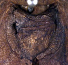 CollectionObject 1520442; dc1b4055-785a-4ef1-8230-ed8026aaa4e0: stridulatory area (lectotype). (CollectionObject).