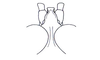 Sclerophilacris corticola Descamps, 1976: Fig. 52. male, fastigium, dorsal view. (Otu).