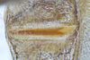 CollectionObject 1593198; ZFMK CI 3261437, e5c6bef4-4516-4406-a53d-7f9fdb55123a: stridulatory file (neotype). (CollectionObject).