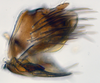 Pygofer, lateral view: (Observation).