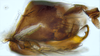 Pygofer, lateral view: (Observation).