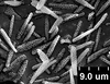 Brochosomes: !! display not done !! on Oncometopia (Oncometopia) orbona (Fabricius, 1798): OM155 | U.S.A., Illinois, Piatt Co., Lodge Park | 6/18/1974 | M. B. Farris | INHS. (Observation).