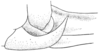 Belocephalus davisi Rehn & Hebard, 1916: Pl. 7 fig. 9. female (Belocephalus davisi) lateral view of apex of abdomen, base of ovipoistor and subginial plate. (Otu).