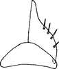 Subgenital plate, ventral view on Cumora scissis (Cheng, 1980): Subgenital plate. (Observation).