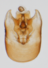 Pygofer, ventral view on Opiconsiva anacharsis (Fennah, 1969): (Observation).