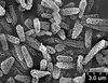 Brochosomes on Cuerna arida Oman & Beamer, 1944: CR778 | U.S.A., Arizona, Cochise Co., Chiricahua Mts., Rustler Park campground, Rakitov R. [#02-46], 24-25 Jul 2002 | INHS. (Observation).