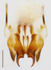 CollectionObject 1585130; 9d597fae-4945-46e2-abd6-81a7a73a2eb3: male genitalia, ventral view (scale bar 0.5 mm). (CollectionObject).